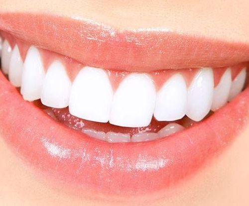 denti+perfetti-720w